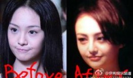 西安整容爆料事件始末视频,真相与争议的漩涡